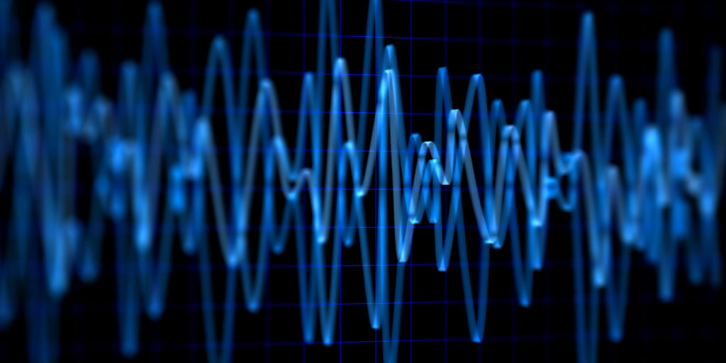 Signal Noise